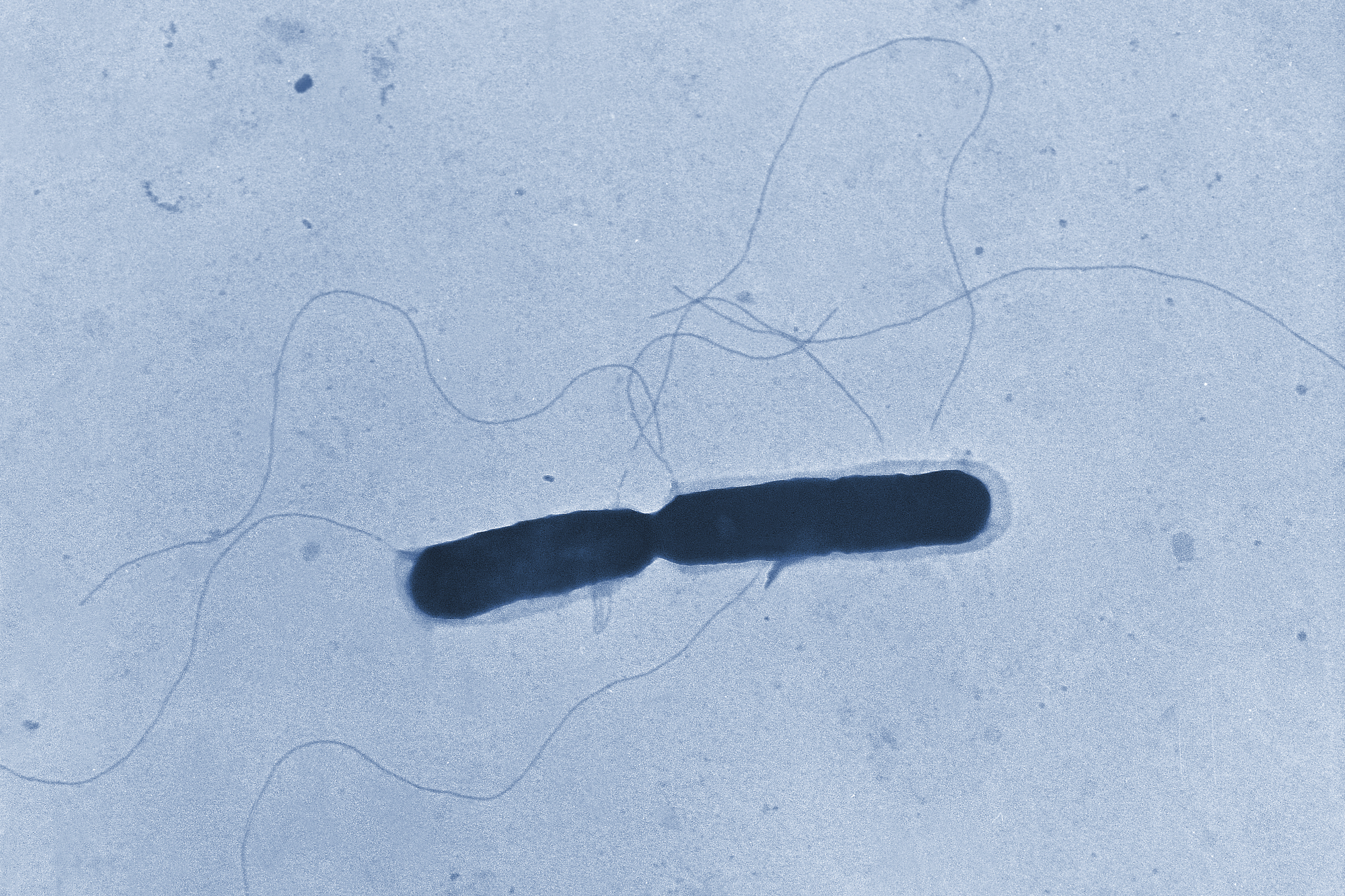 Esta imagen de microscopio proporcionada por los Centros para el Control y la Prevención de...